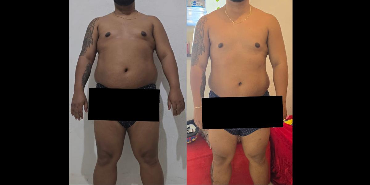 Antes e Depois Aluno 2