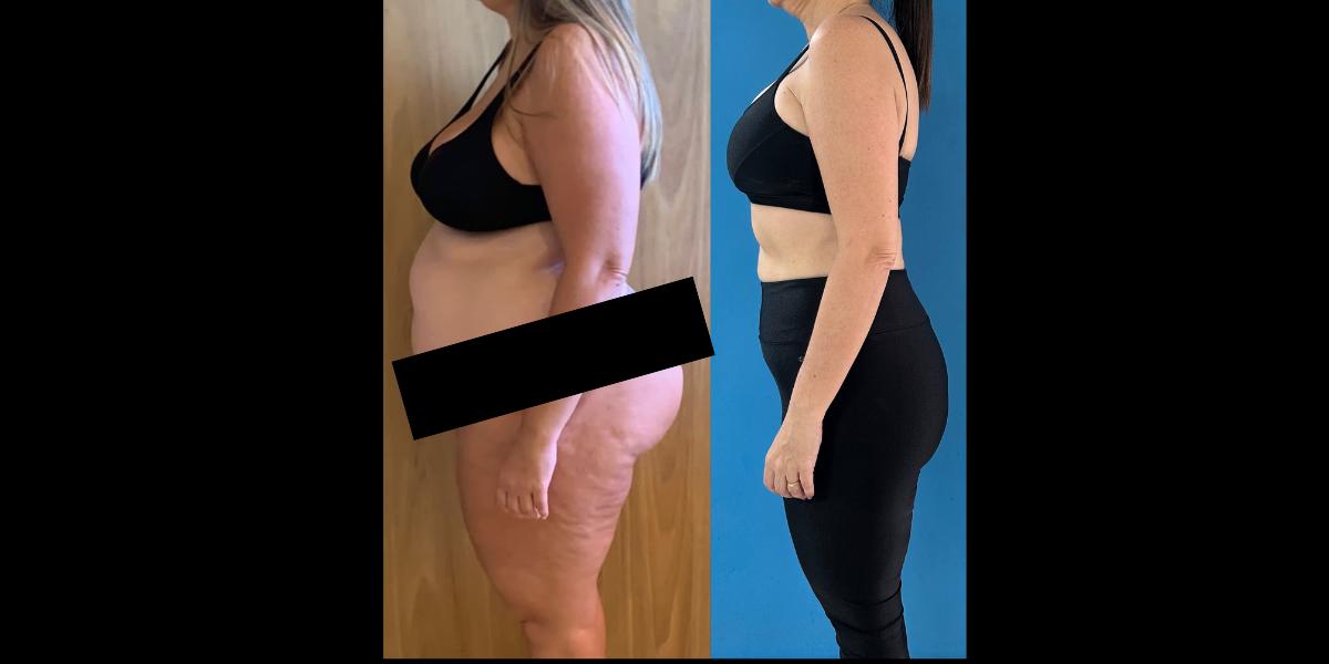 Antes e Depois Aluno 1